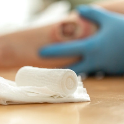 doctor treating wound west coast wound care